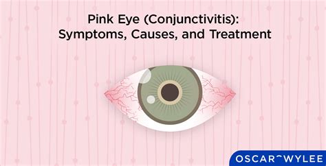 Pink Eye Conjunctivitis Symptoms Causes And Treatment