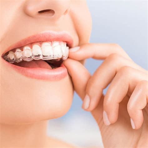 Orthodontics Smart And Fun Dental Care Do Good Dental Tempe Az