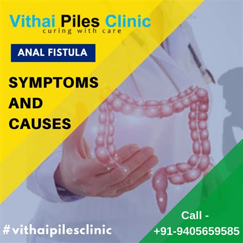 Fistula Symptoms And Causes Fistula Treatment