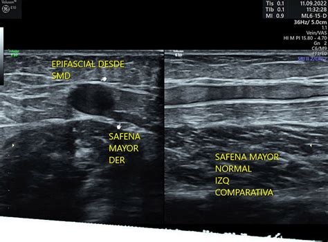 Vascular Ultrasonidos En Mérida Diagnóstico Integrado