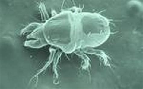 How Does A Dust Mite Infestation Occur Hunker