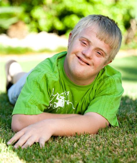 What Are The Characteristics Of Babies With Down Syndrome
