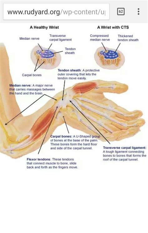 Two major problems associated with tendons include tendonitis and tenosynovitis. Pin on Anatomical references