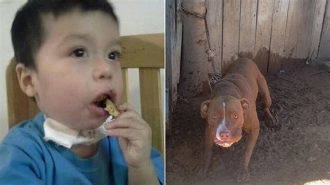 Pit Bull Attacks 1 Year Old Boy In California Rips Off Ear Abc11