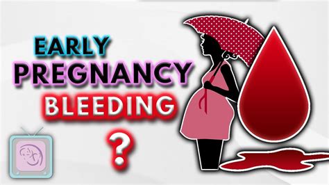 Implantation Bleeding Early Pregnancy Bleeding Spotting Important Facts YouTube