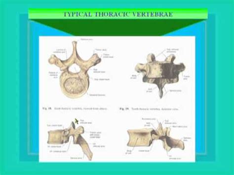 Typical thoracic vertebrae have several features distinct from those typical of cervical or lumbar it varies by the individual, but t10 may resemble the atypical nature of the 11 and 12 vertebrae. 04- Typical Thoracic Vertebrae - YouTube