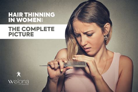Hair Thinning In Women The Complete Picture