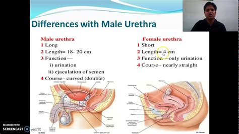 Pictures Of Swollen Urethra Female Urethra This Is A Demonstration Of A Female Bimanual