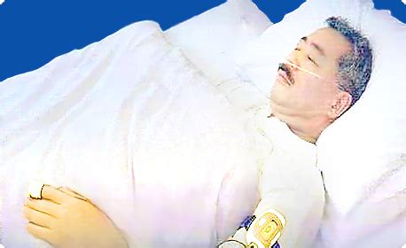 睡眠時無呼吸症候群｜水俣協立病院