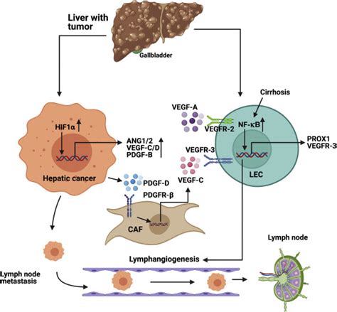 Targeting Lymphangiogenesis And Lymph Node Metastasis In Liver Cancer