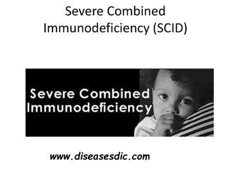 Severe Combined Immunodeficiency Scid Overview