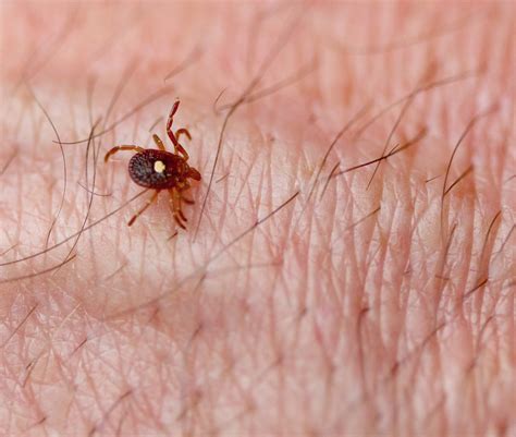 How A Tick Bite Can Make You Allergic To Red Meat Florida Ent And Allergy