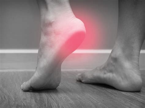 Common Foot Problem — Plantar Fasciitis — And How To Treat This Painful