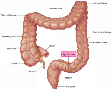 Sigmoid Colon Anatomy Location Function Polyps Diverticulosis And Cancer
