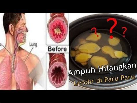 Hal ini dikarenakan kandungan bromelain dalam nanas. Cara Menghilangkan Dahak Secara Cepat - Zafrina