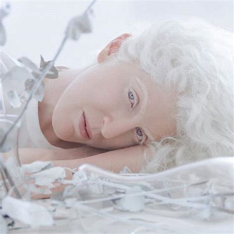 Stunning Portraits Showing Albinism S Beauty