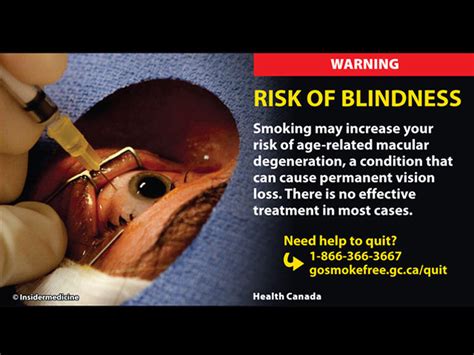 Yikes Gruesome New Tobacco Warning Labels From Canada Photo 1 Cbs News