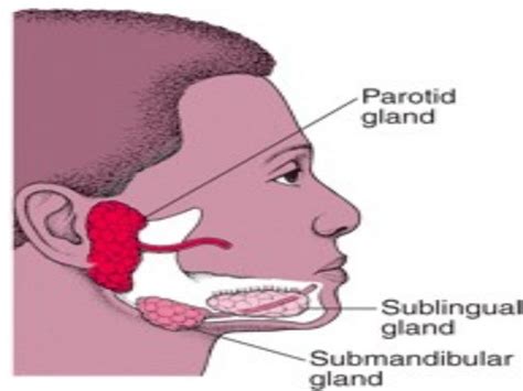 Salivary Gland Infections