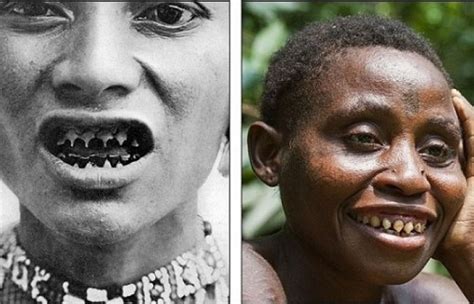 Most Extreme Body Modifications In The World Revealed Photos Body