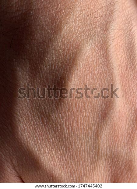 Closeup Skin Protruding Veins Hand Stock Photo 1747445402 Shutterstock