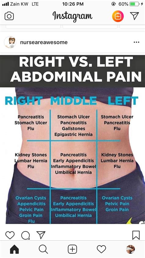 Pin On Abdominal Pain