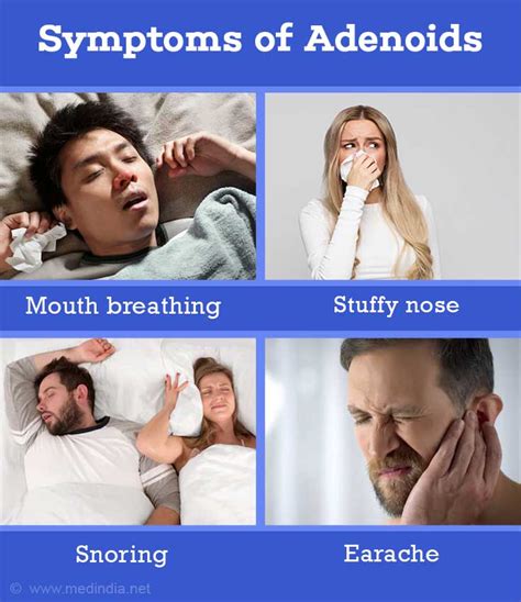 Adenoids Adenoiditis Causes Symptoms Complications Diagnosis