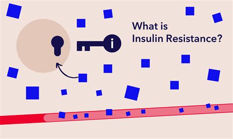 The Loop Blog Blog Archive What Is Insulin Resistance The Loop Blog