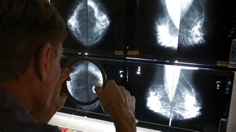 New Mammogram Guidelines For Women Recently Vaccinated For Covid 19