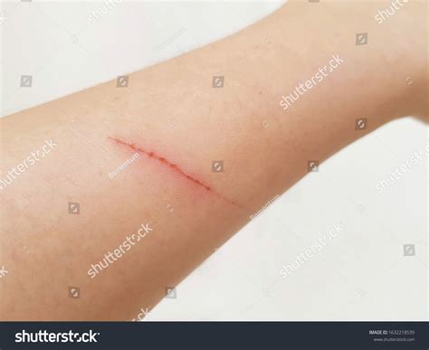 Cat Dog Scratch On Arm Isolated Stock Photo 1632218539 Shutterstock