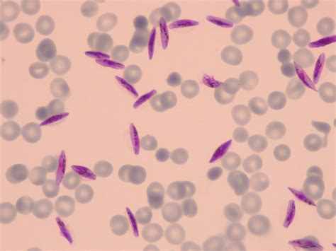 New Understanding Of Parasite Biology Might Help Stop Malaria Transmission