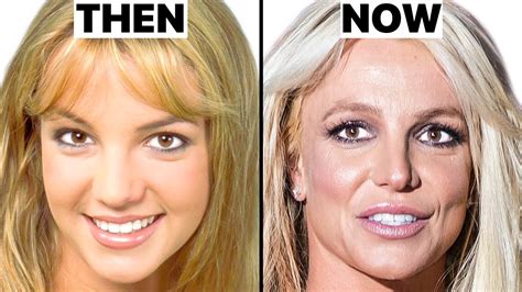 Britney Spears New Face Plastic Surgery Analysis Youtube