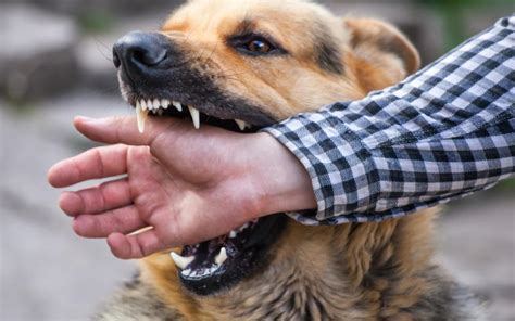 What You Should Immediately Do If Youve Received A Dog Bite Wound