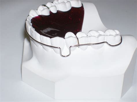 Orthodontic Dental Retainers Fox Valley Ortho Lab