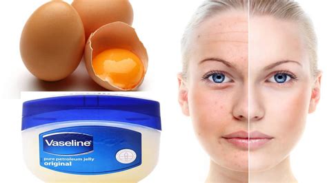 Vaseline And Egg Yolk Remedy To Look 10 Times Younger Health Gadgetsng