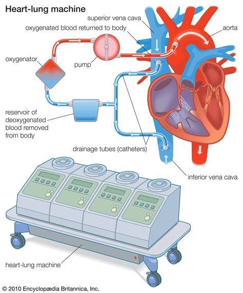 Artificial Heart Benefits Risks And History Britannica