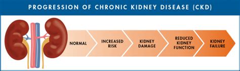Chronic Kidney Disease Caritas Medical Center