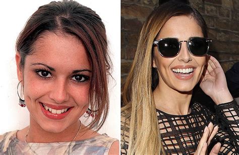 Celebrity Smile Transformations Irish Mirror Online