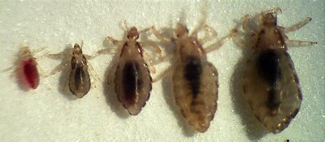 Lice On The Road Beating Lice In 12 Easy Steps