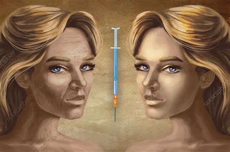 Cosmetic Surgery Illustration Stock Image F0194793 Science
