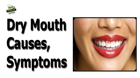 Dry Mouth Causes Symptoms And Treatment Youtube