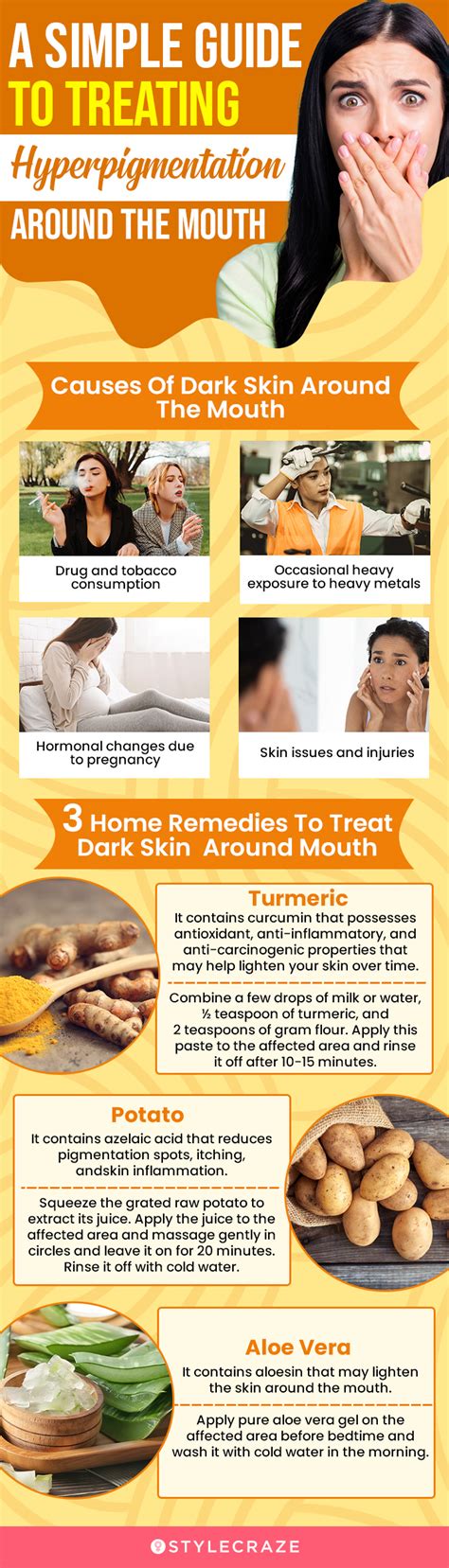 Your Go To Guide For Treating Hyperpigmentation Around Mouth