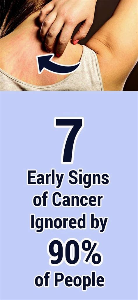 Pin By Daryakurnyayeva On Health Cancer Sign Health Cancer