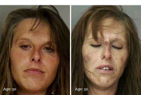 Just A Few Years Of Drug Abuse Transformed This Woman S Face Making Her