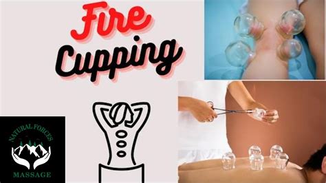 Cupping Therapy Youtube