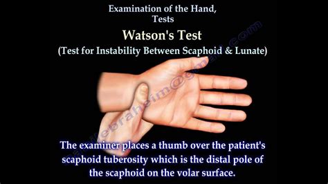 Examination Of The Hand Tests Everything You Need To Know Dr