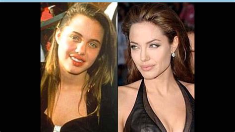 Анджелина Джоли До И После Пластики Фото подборка фото