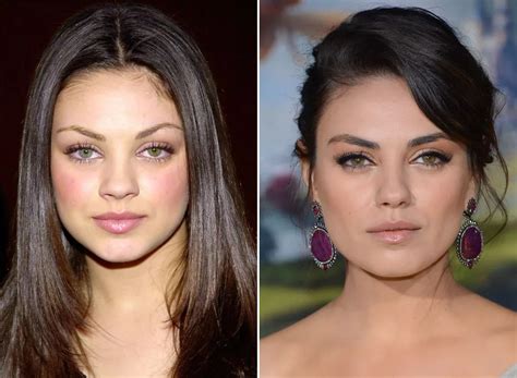 Mila Kunis Before And After Celebrity Plastic Surgery Mila Kunis