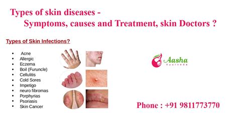 Types Of Skin Conditions