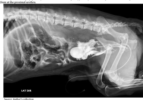 Figure 1 From Primary Surgical Repair Of Prostatic Urethral Rupture