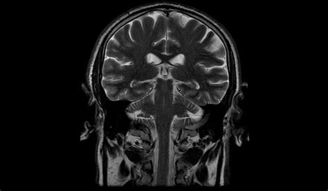 Brain Mri Scan Of Healthy Male High Resolution Stock Photo Download